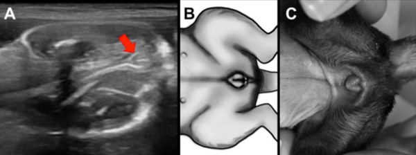 CRV Imagem, Dra Tilde Froes, Ultrassonografia Gestacional